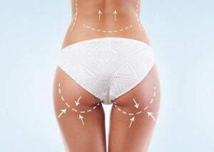 Lipofilling fesses Tunisie