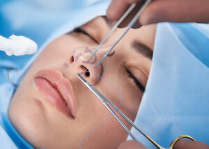Rhinoplastie en Tunisie
