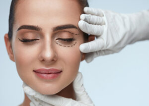 blépharoplastie Tunisie