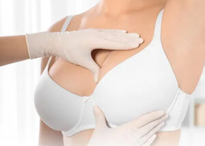 Lipofilling mammaire